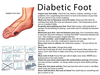 Diabetes Symptoms Feet Image