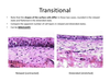 Transitional Epithelium Image