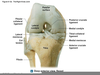 Posterior Fibular Head Image