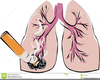 Smoking Lungs Clipart Image