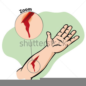 Cough Blood Clipart | Free Images at Clker.com - vector clip art online ...